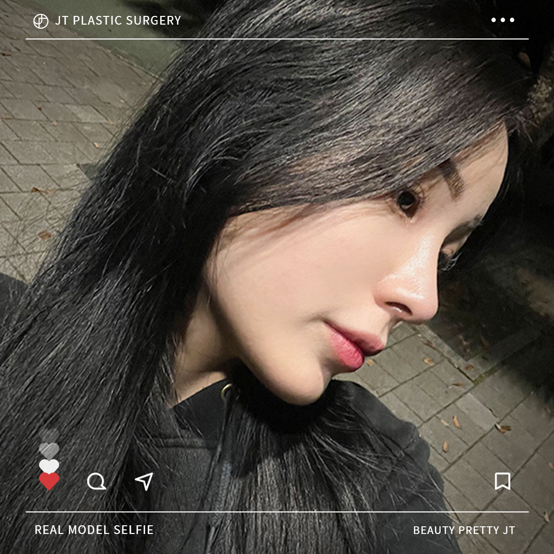 썸네일 썸네일
