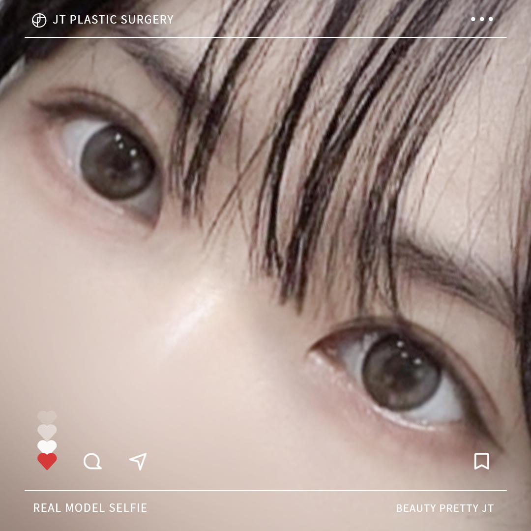 썸네일 썸네일