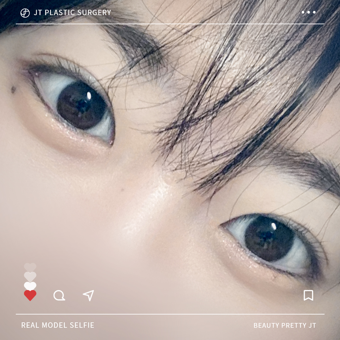 썸네일 썸네일