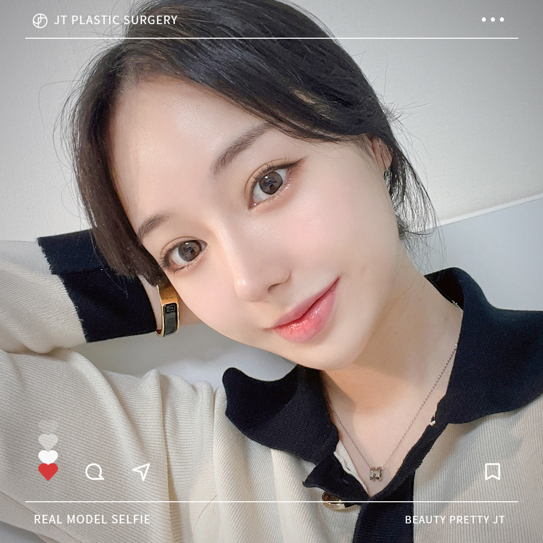 썸네일 썸네일