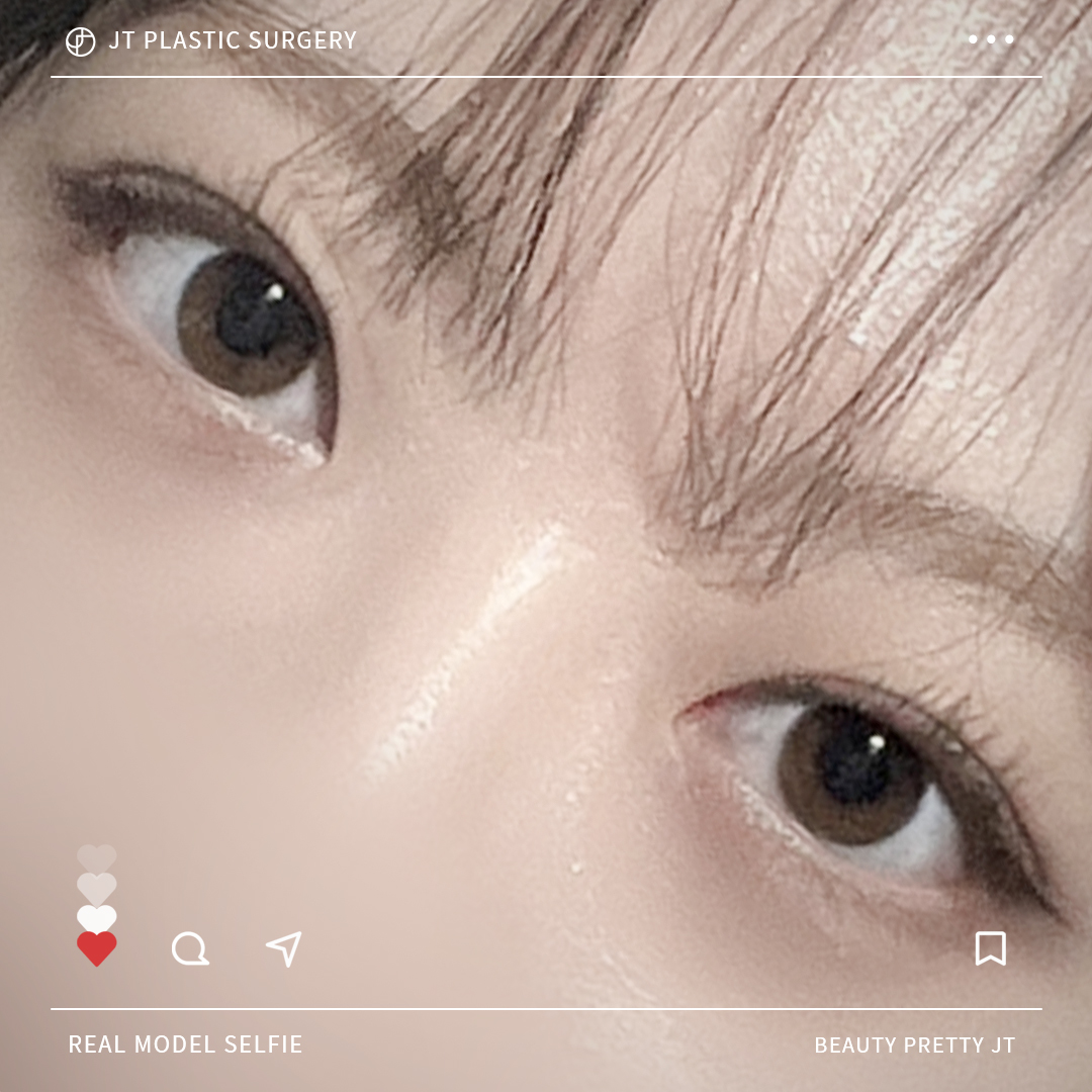 썸네일 썸네일