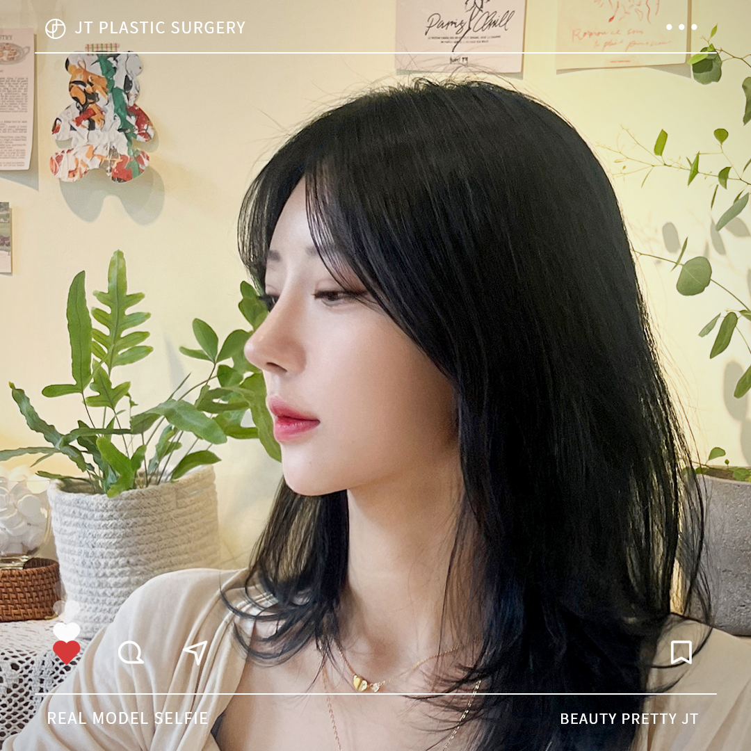 썸네일 썸네일