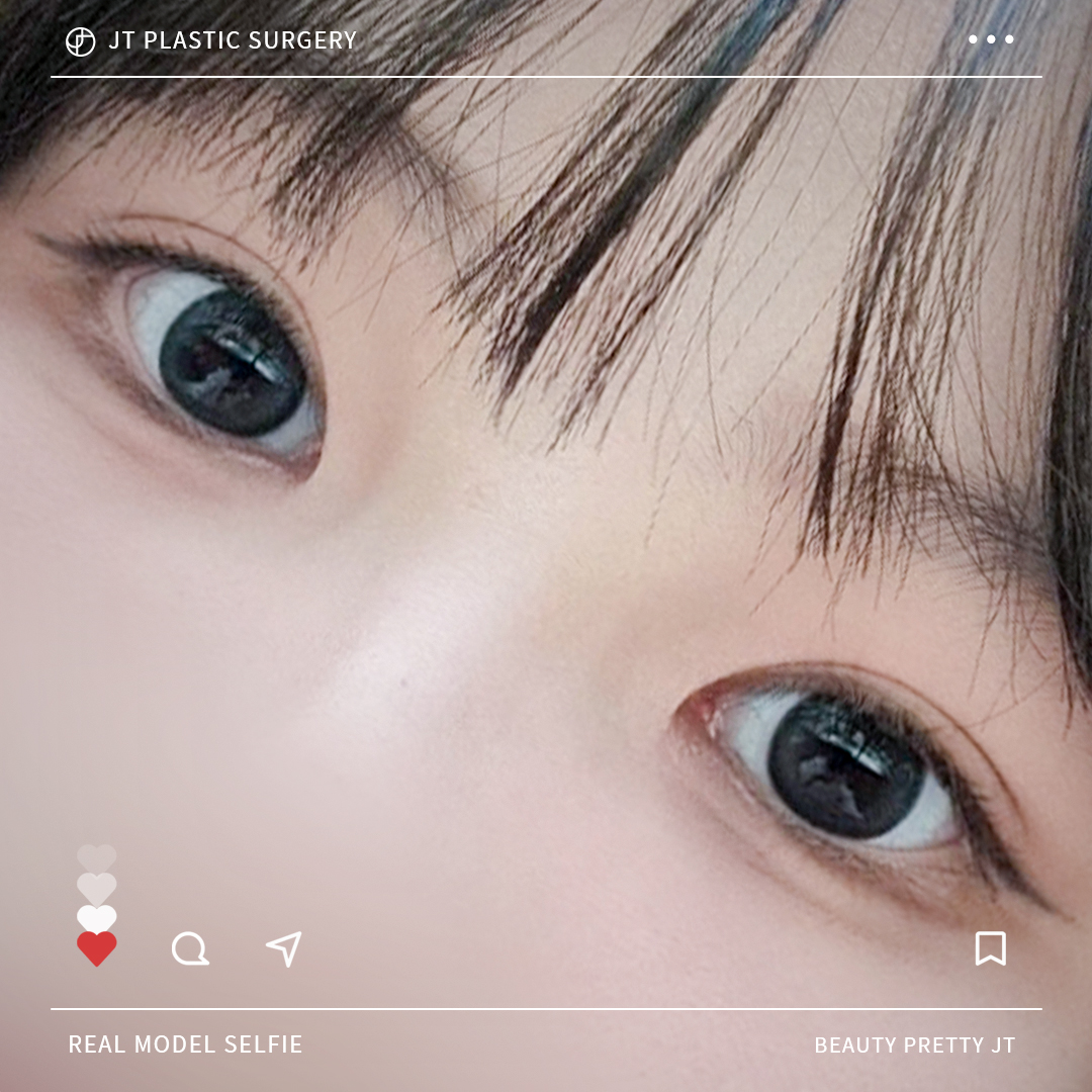 썸네일 썸네일
