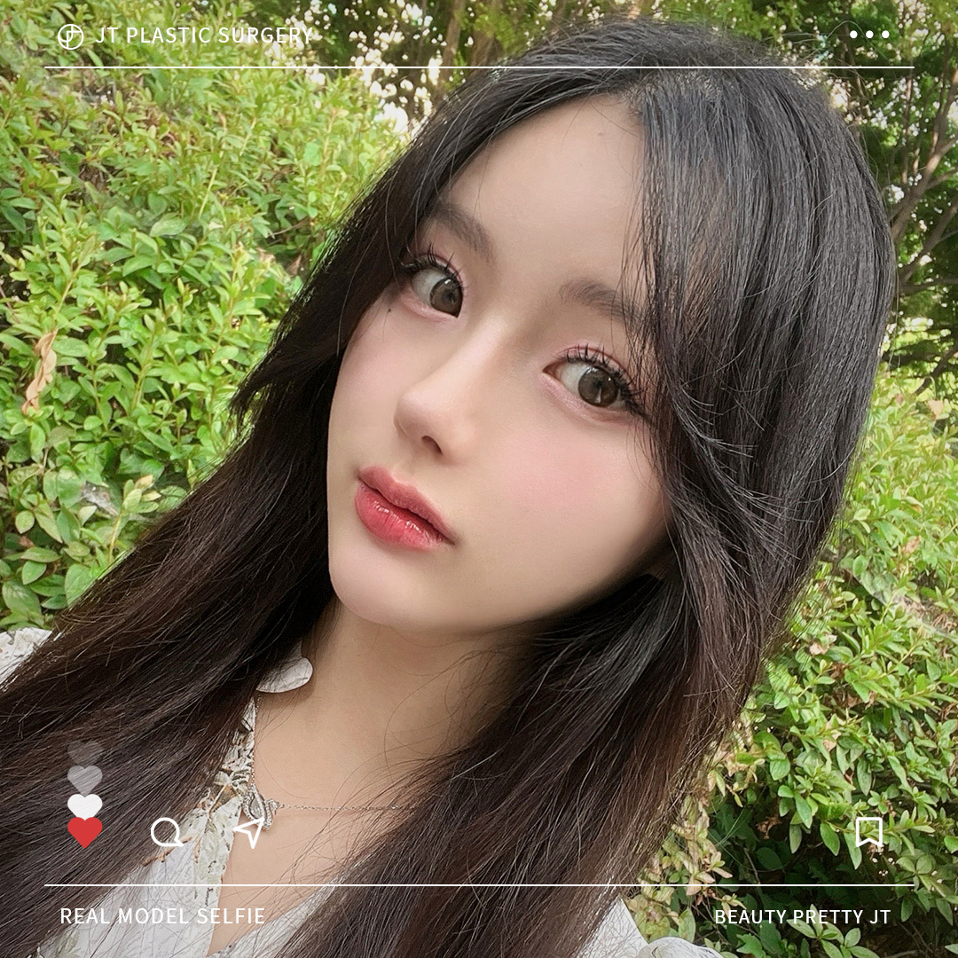 썸네일 썸네일