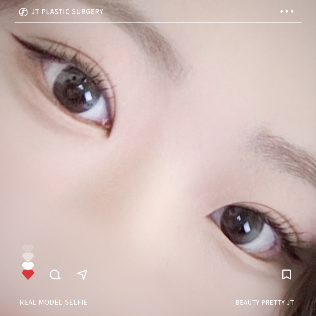 썸네일 썸네일