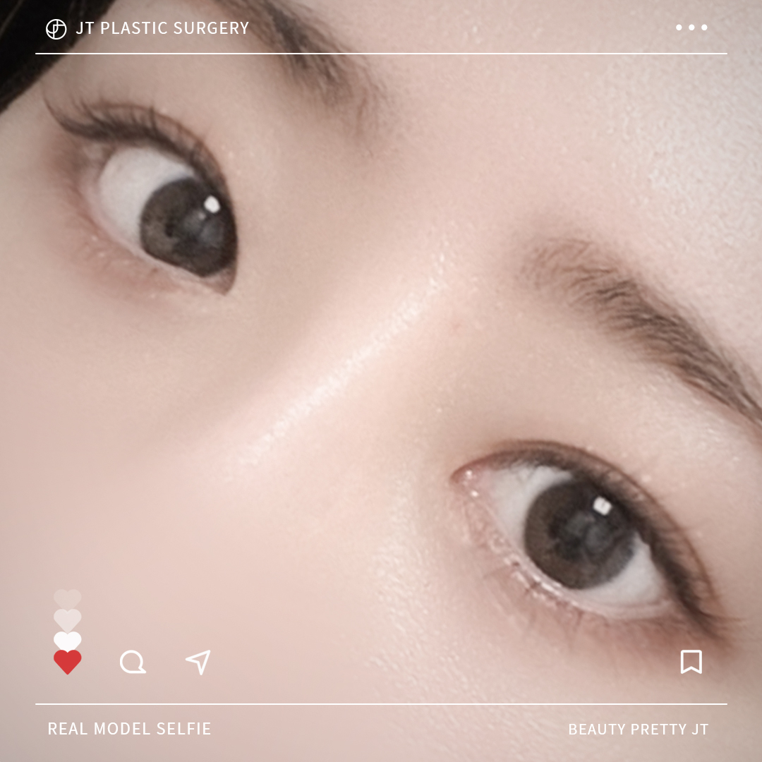 썸네일 썸네일