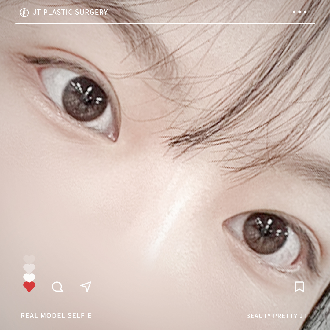 썸네일 썸네일