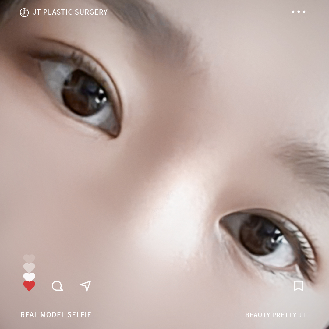 썸네일 썸네일