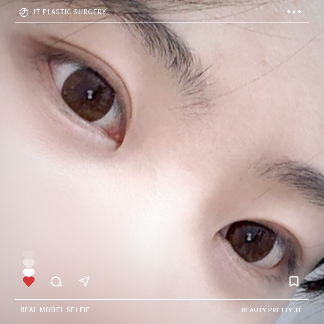 썸네일 썸네일