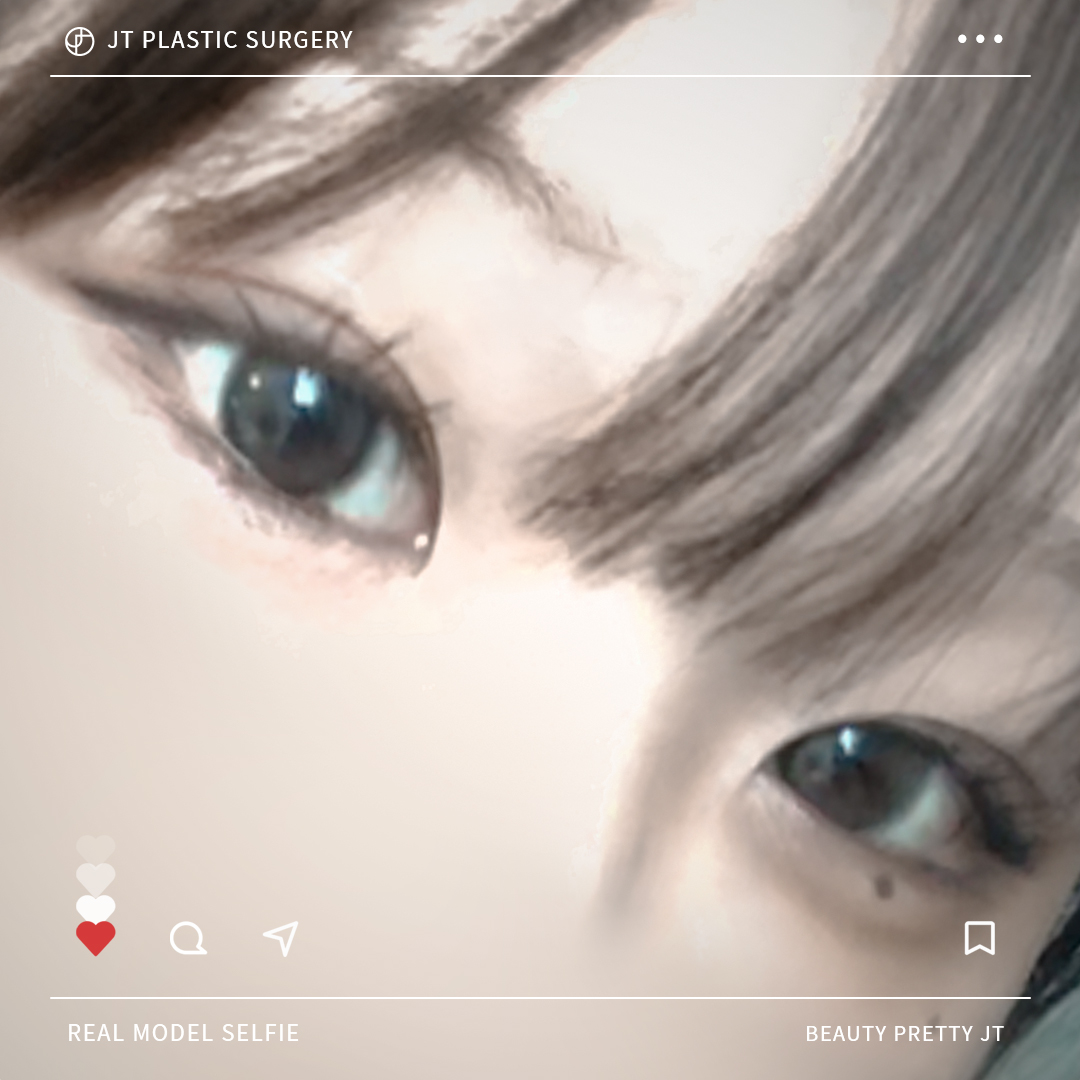 썸네일 썸네일