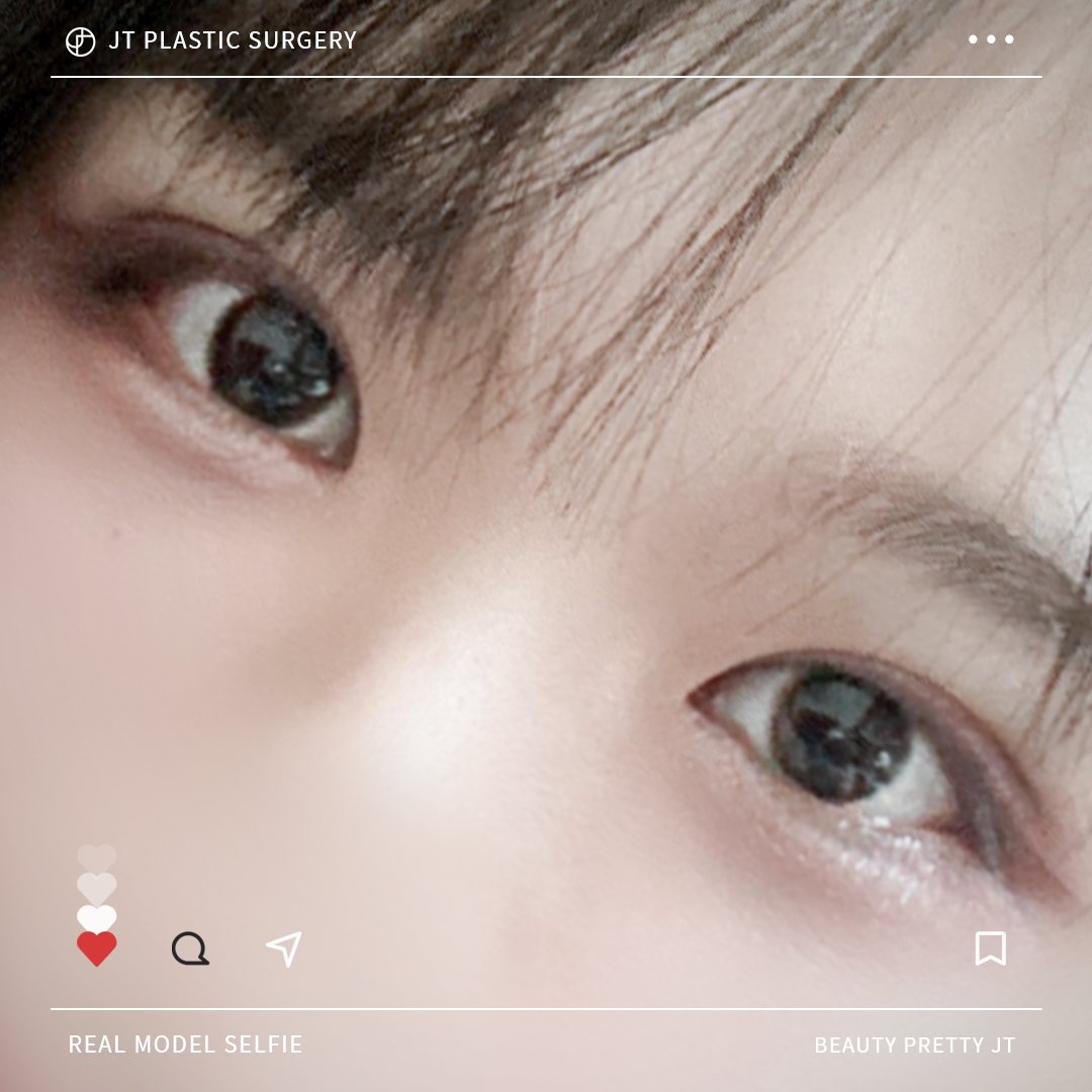 썸네일 썸네일