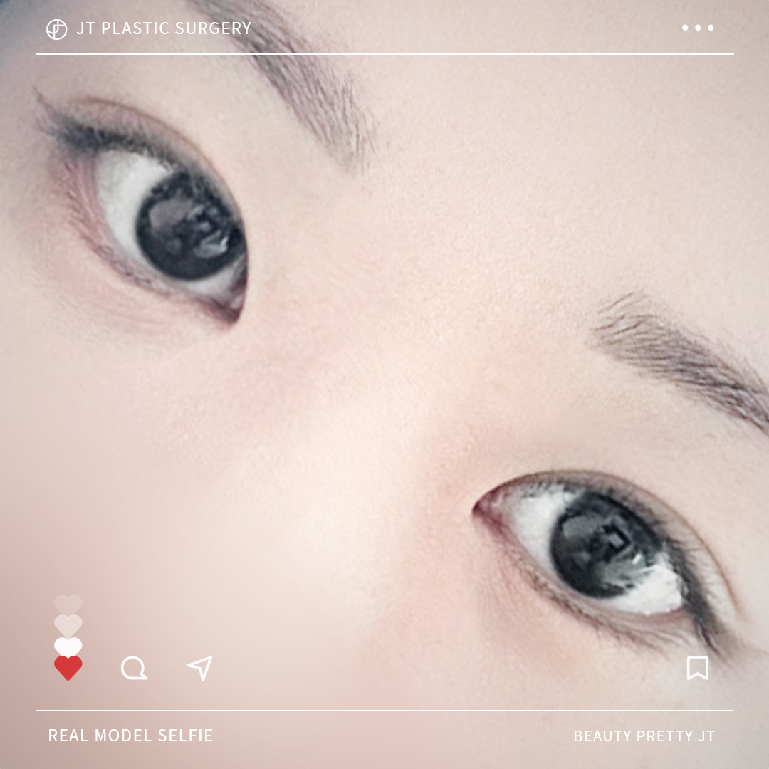 썸네일 썸네일