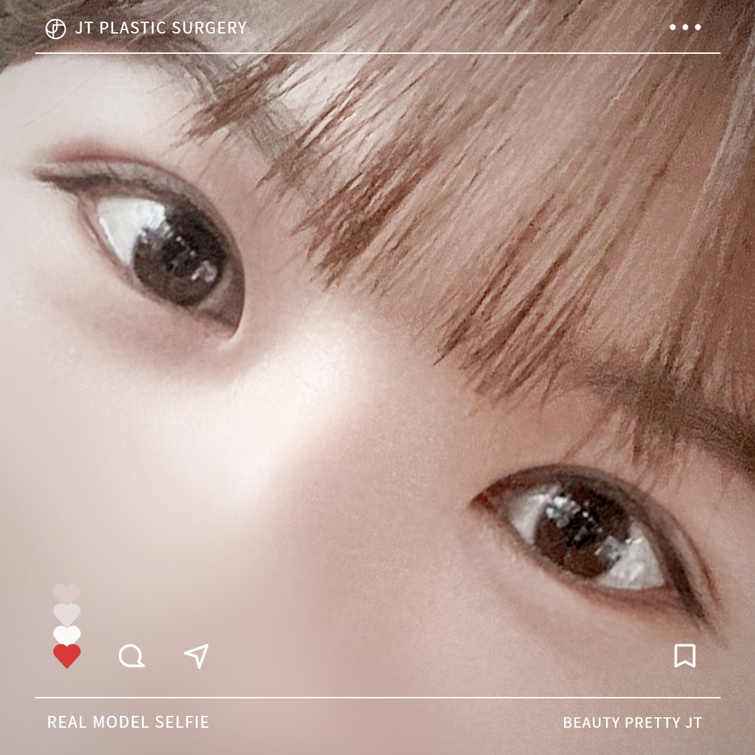 썸네일 썸네일