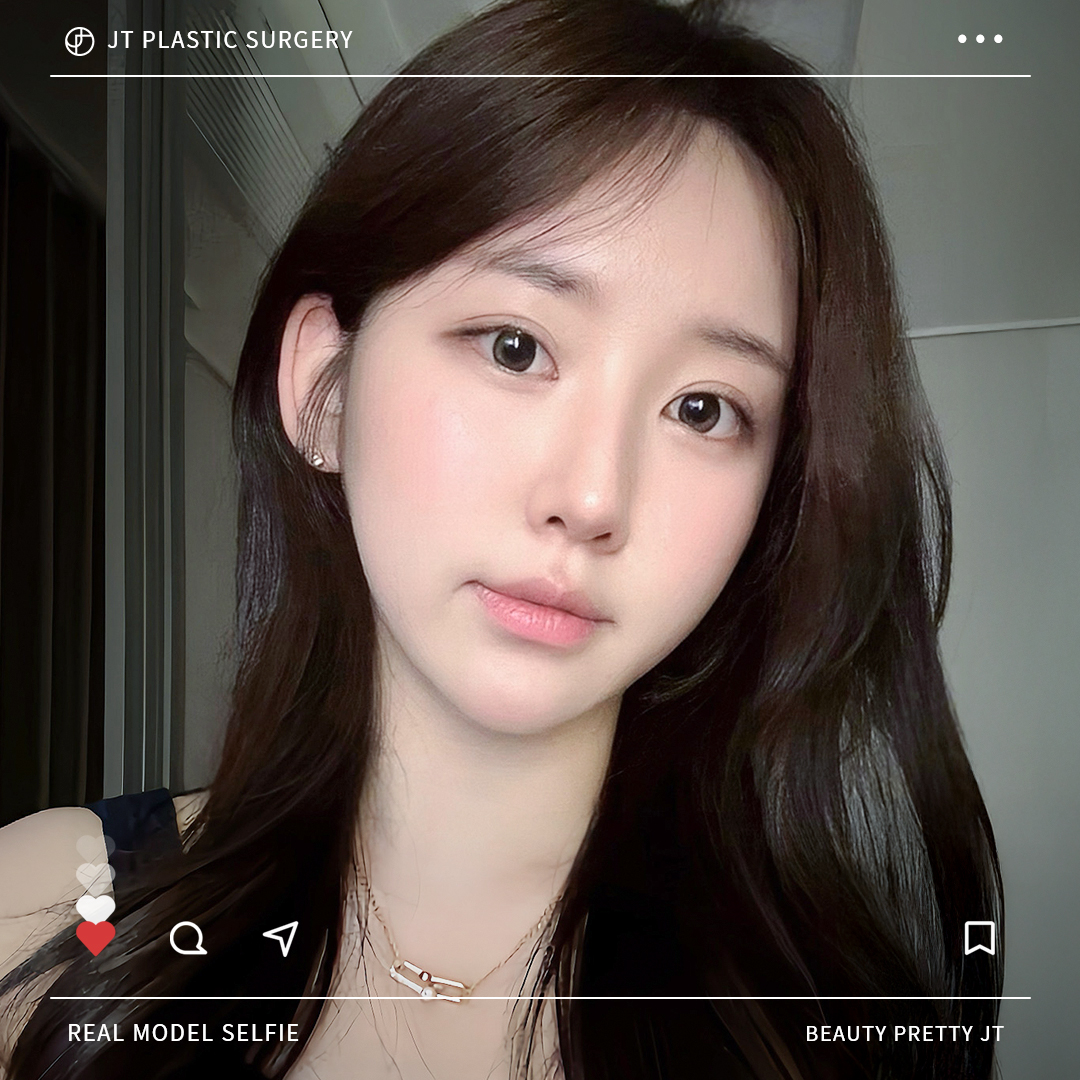 썸네일 썸네일